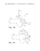 Apparatus and Method for Fabricating a Customized Patient-Specific Orthopaedic Instrument diagram and image