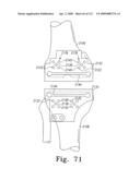 Apparatus and Method for Fabricating a Customized Patient-Specific Orthopaedic Instrument diagram and image