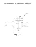 Apparatus and Method for Fabricating a Customized Patient-Specific Orthopaedic Instrument diagram and image