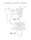 Apparatus and Method for Fabricating a Customized Patient-Specific Orthopaedic Instrument diagram and image