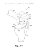 Apparatus and Method for Fabricating a Customized Patient-Specific Orthopaedic Instrument diagram and image