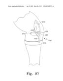 Apparatus and Method for Fabricating a Customized Patient-Specific Orthopaedic Instrument diagram and image