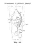 Apparatus and Method for Fabricating a Customized Patient-Specific Orthopaedic Instrument diagram and image