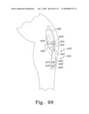 Apparatus and Method for Fabricating a Customized Patient-Specific Orthopaedic Instrument diagram and image