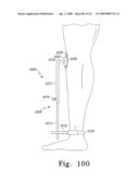 Apparatus and Method for Fabricating a Customized Patient-Specific Orthopaedic Instrument diagram and image