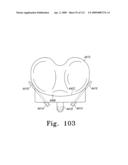 Apparatus and Method for Fabricating a Customized Patient-Specific Orthopaedic Instrument diagram and image