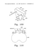 Apparatus and Method for Fabricating a Customized Patient-Specific Orthopaedic Instrument diagram and image