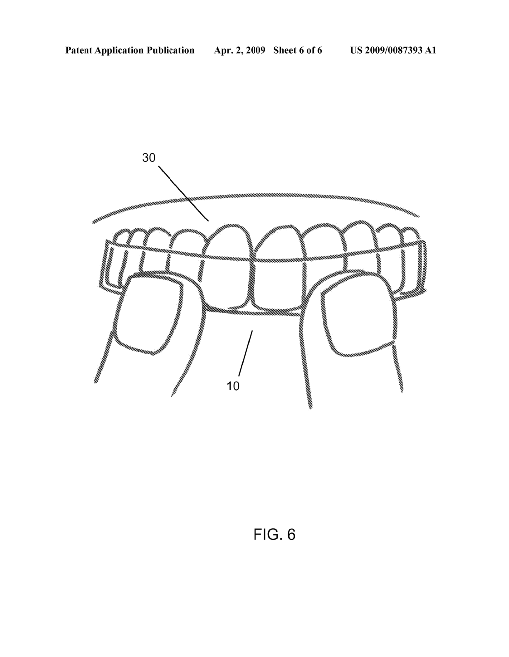 Dental Treatment Compositions and Conformable Dental Treatment Trays Using the Same - diagram, schematic, and image 07