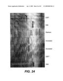 ANTI-FC-GAMMA RIIB RECEPTOR ANTIBODY AND USES THEREFOR diagram and image