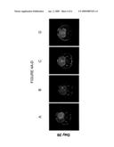 NFIA IN GLIAL FATE DETERMINATION, GLIOMA THERAPY AND ASTROCYTOMA TREATMENT diagram and image