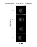 NFIA IN GLIAL FATE DETERMINATION, GLIOMA THERAPY AND ASTROCYTOMA TREATMENT diagram and image