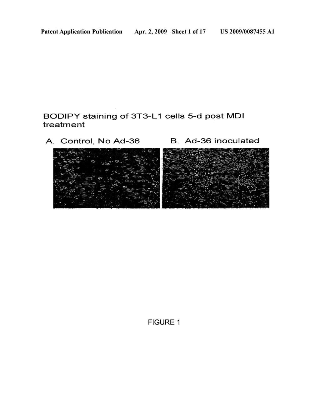 ADIPOGENIC ADENOVIRUSES AS A BIOMARKER FOR DISEASE - diagram, schematic, and image 02