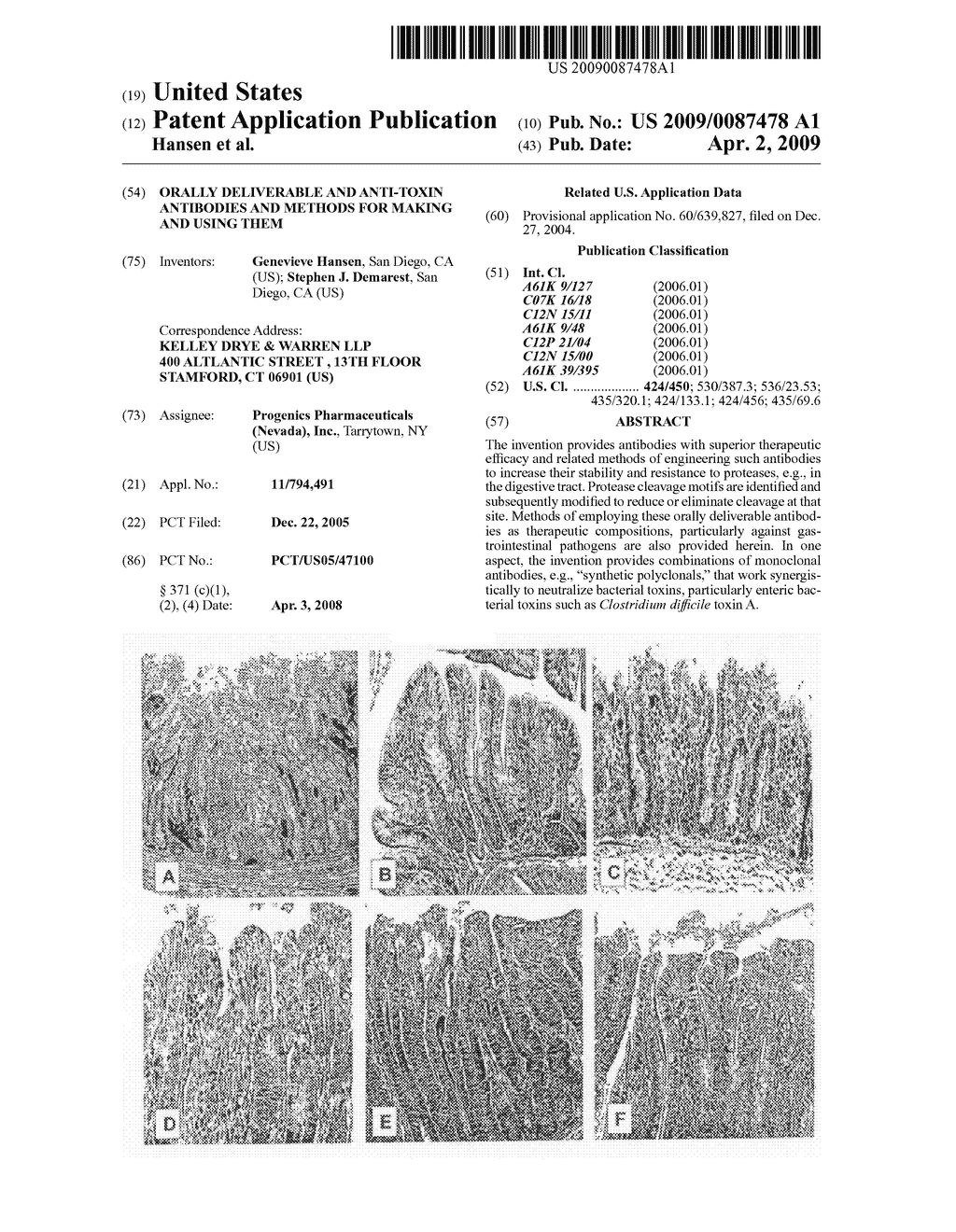 Orally Deliverable and Anti-Toxin Antibodies and Methods for Making and Using Them - diagram, schematic, and image 01