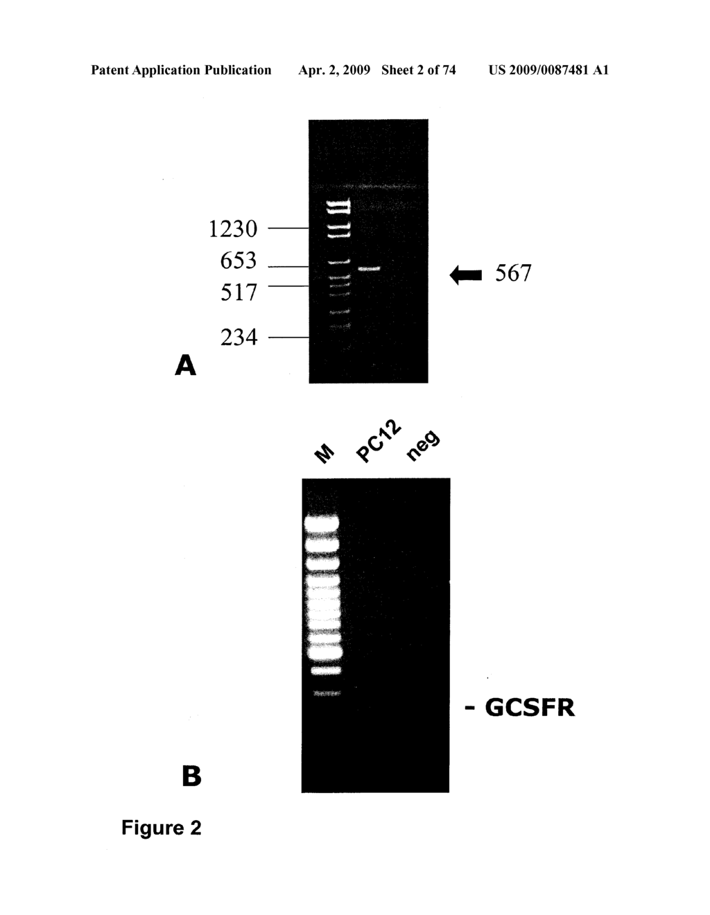 METHODS OF TREATING NEUROLOGICAL CONDITIONS WITH HEMATOPOEITIC GROWTH FACTORS - diagram, schematic, and image 03