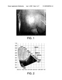 Optical Therapeutic Treatment Device diagram and image