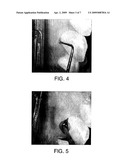 Optical Therapeutic Treatment Device diagram and image