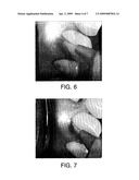 Optical Therapeutic Treatment Device diagram and image