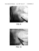 Optical Therapeutic Treatment Device diagram and image