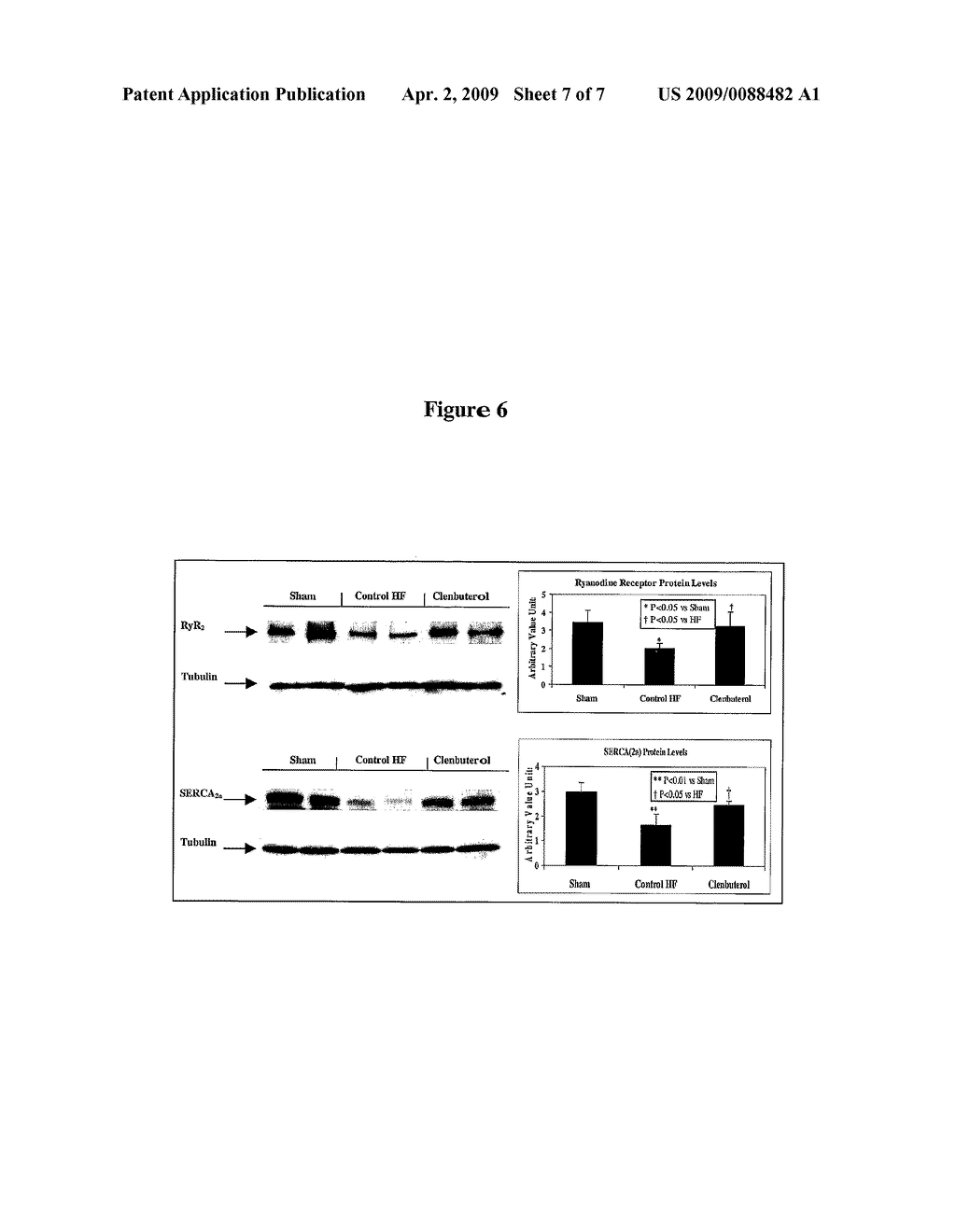 Compositions and Methods For Treating Heart Failure - diagram, schematic, and image 08