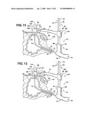 Method of accessing a bladder and associated apparatus therefor diagram and image