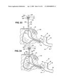 Method of accessing a bladder and associated apparatus therefor diagram and image