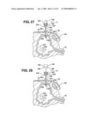 Method of accessing a bladder and associated apparatus therefor diagram and image