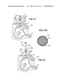 Method of accessing a bladder and associated apparatus therefor diagram and image