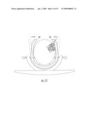 MRI-COMPATIBLE HEAD FIXATION FRAME WITH COOPERATING HEAD COIL APPARATUS diagram and image