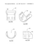 MRI-COMPATIBLE HEAD FIXATION FRAME WITH COOPERATING HEAD COIL APPARATUS diagram and image