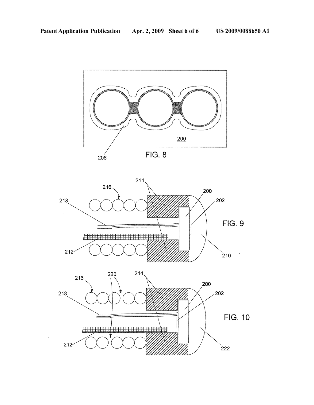 INTRAVASCULAR PRESSURE DEVICES INCORPORATING SENSORS MANUFACTURED USING DEEP REACTIVE ION ETCHING - diagram, schematic, and image 07