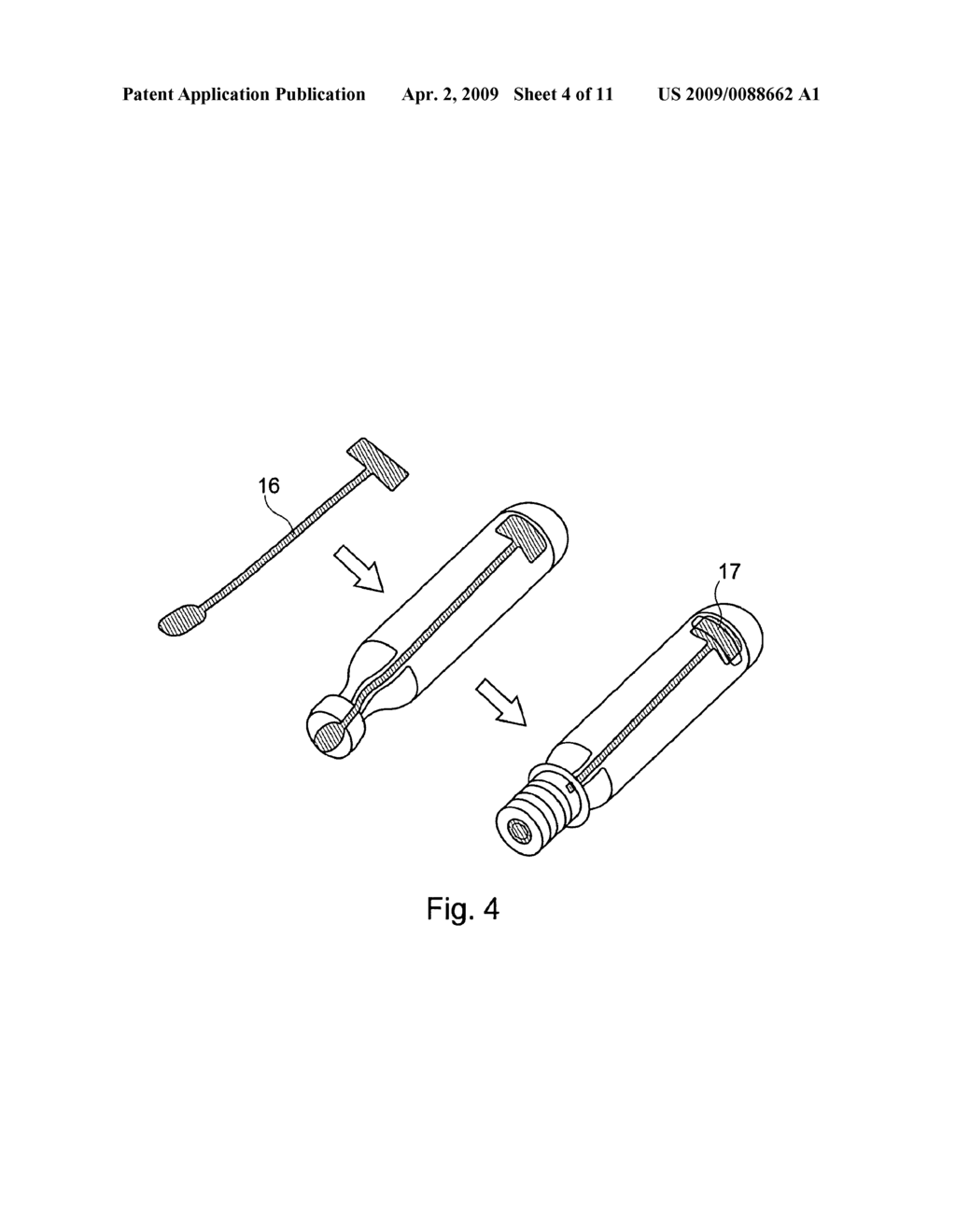 Determination of Position of Injection Needle - diagram, schematic, and image 05