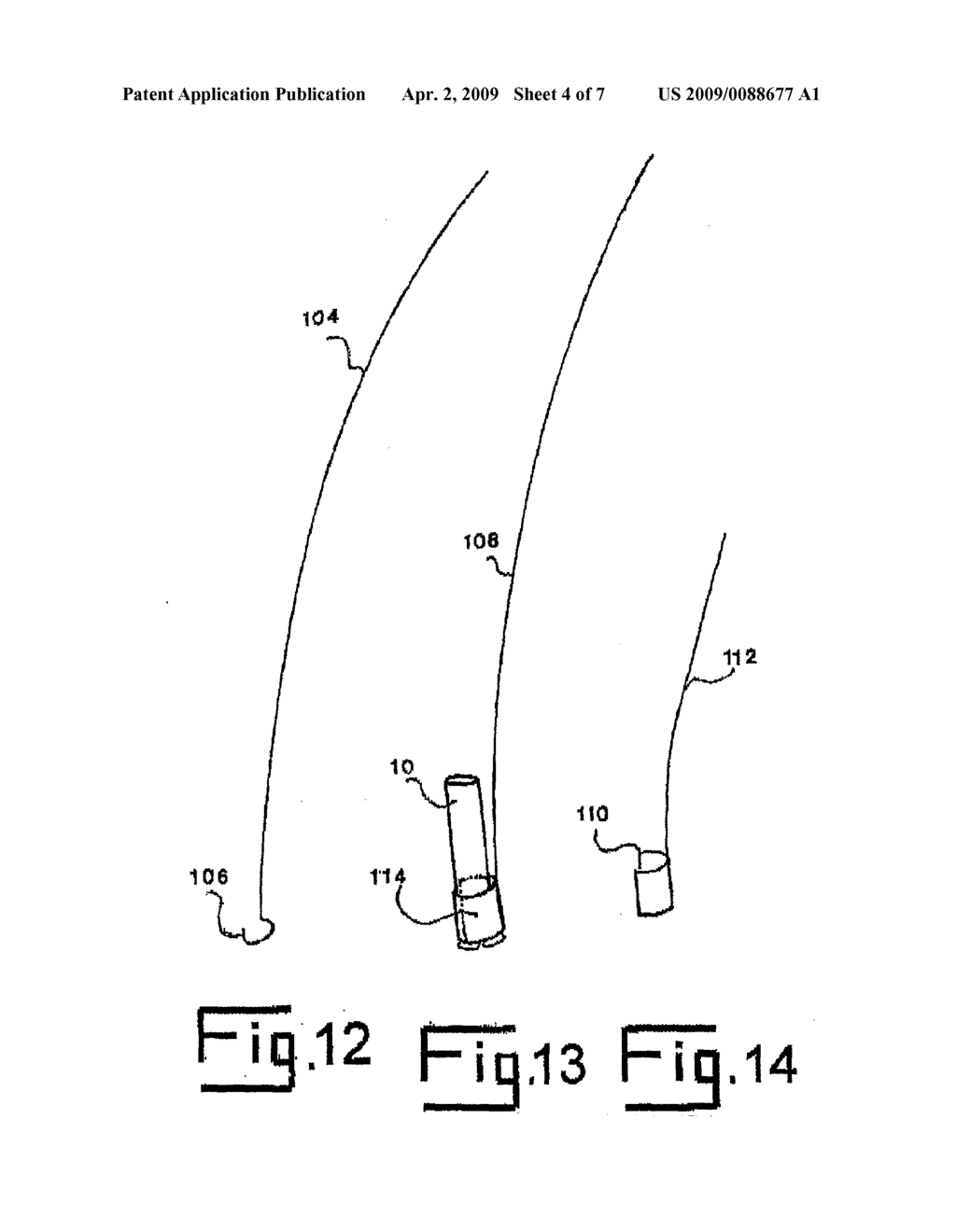 EAR TUBES - diagram, schematic, and image 05