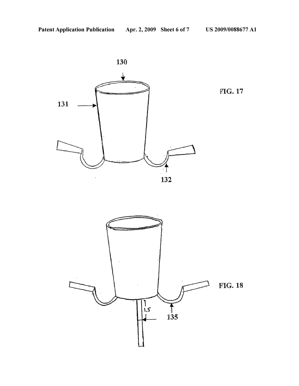 EAR TUBES - diagram, schematic, and image 07