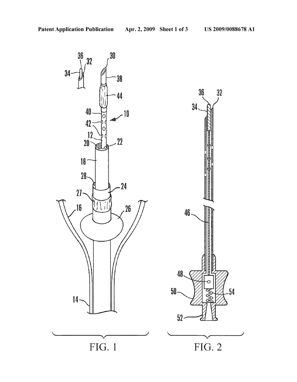 TRANSLUMENAL PERITONEAL ACCESS AND CATHETER THEREFOR - diagram, schematic, and image 02