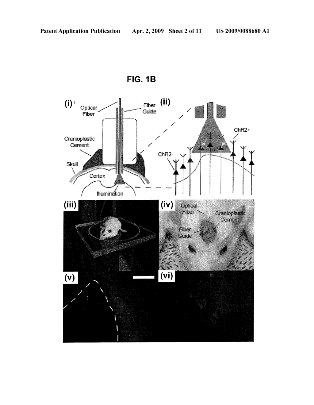 OPTICAL TISSUE INTERFACE METHOD AND APPARATUS FOR STIMULATING CELLS - diagram, schematic, and image 03
