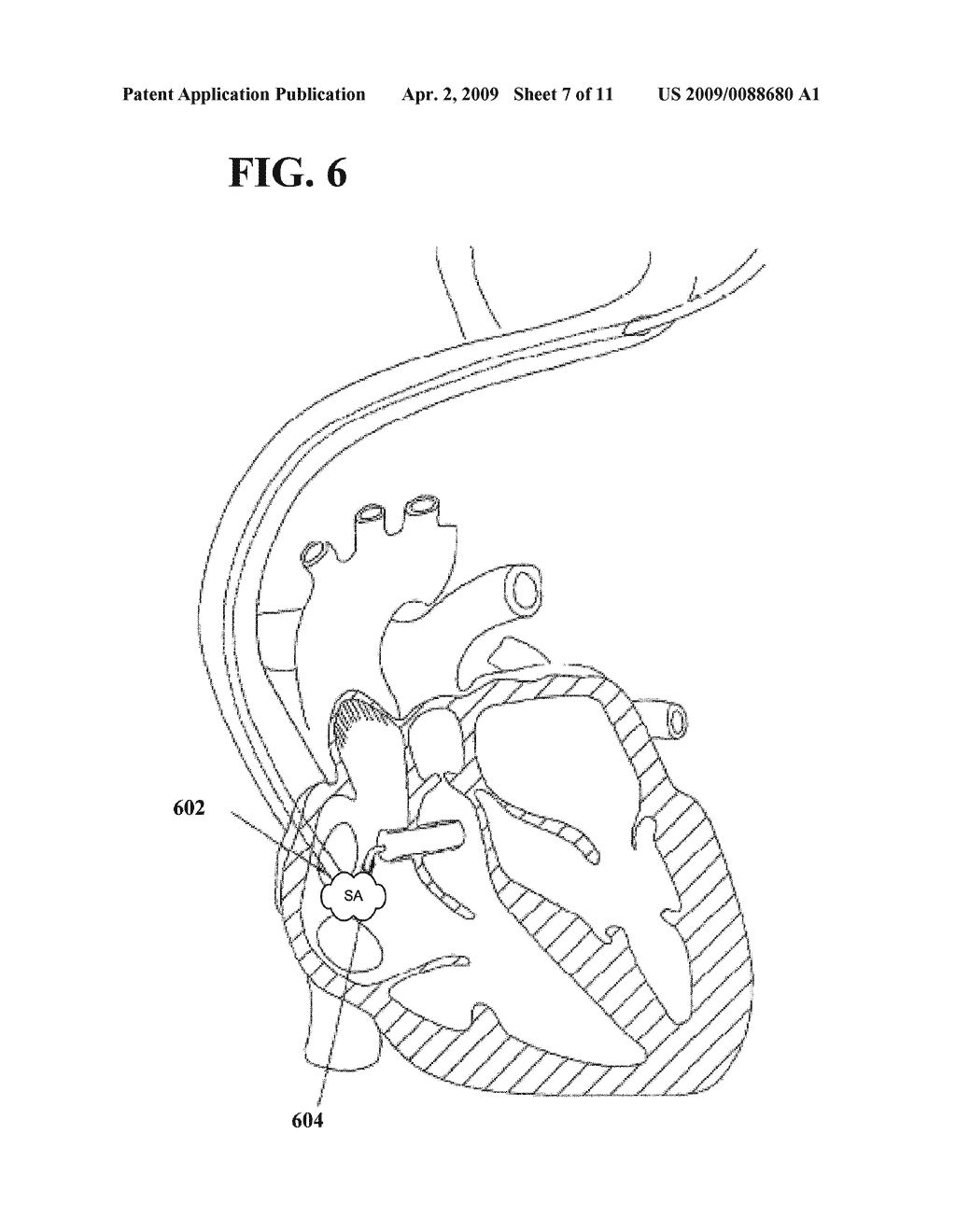 OPTICAL TISSUE INTERFACE METHOD AND APPARATUS FOR STIMULATING CELLS - diagram, schematic, and image 08