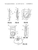 Illuminated fluid collection bag diagram and image