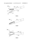 Insulating Mechanically-Interfaced Adhesive for Electrosurgical Forceps diagram and image