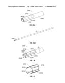 Insulating Mechanically-Interfaced Adhesive for Electrosurgical Forceps diagram and image