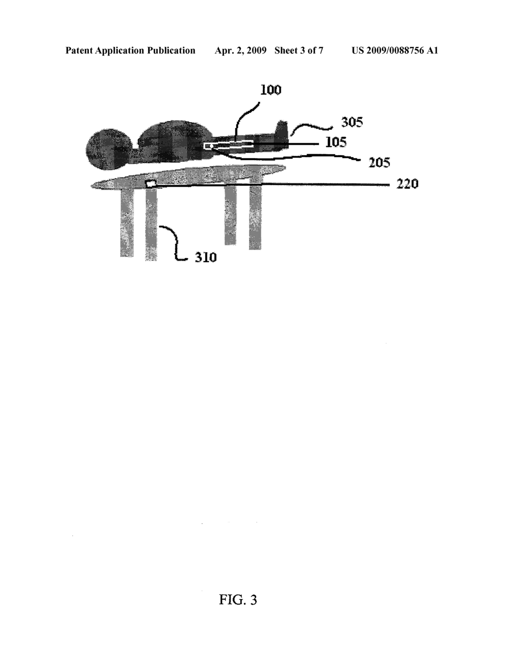 SYSTEM AND METHOD FOR SECURING SURGICAL IMPLANT - diagram, schematic, and image 04