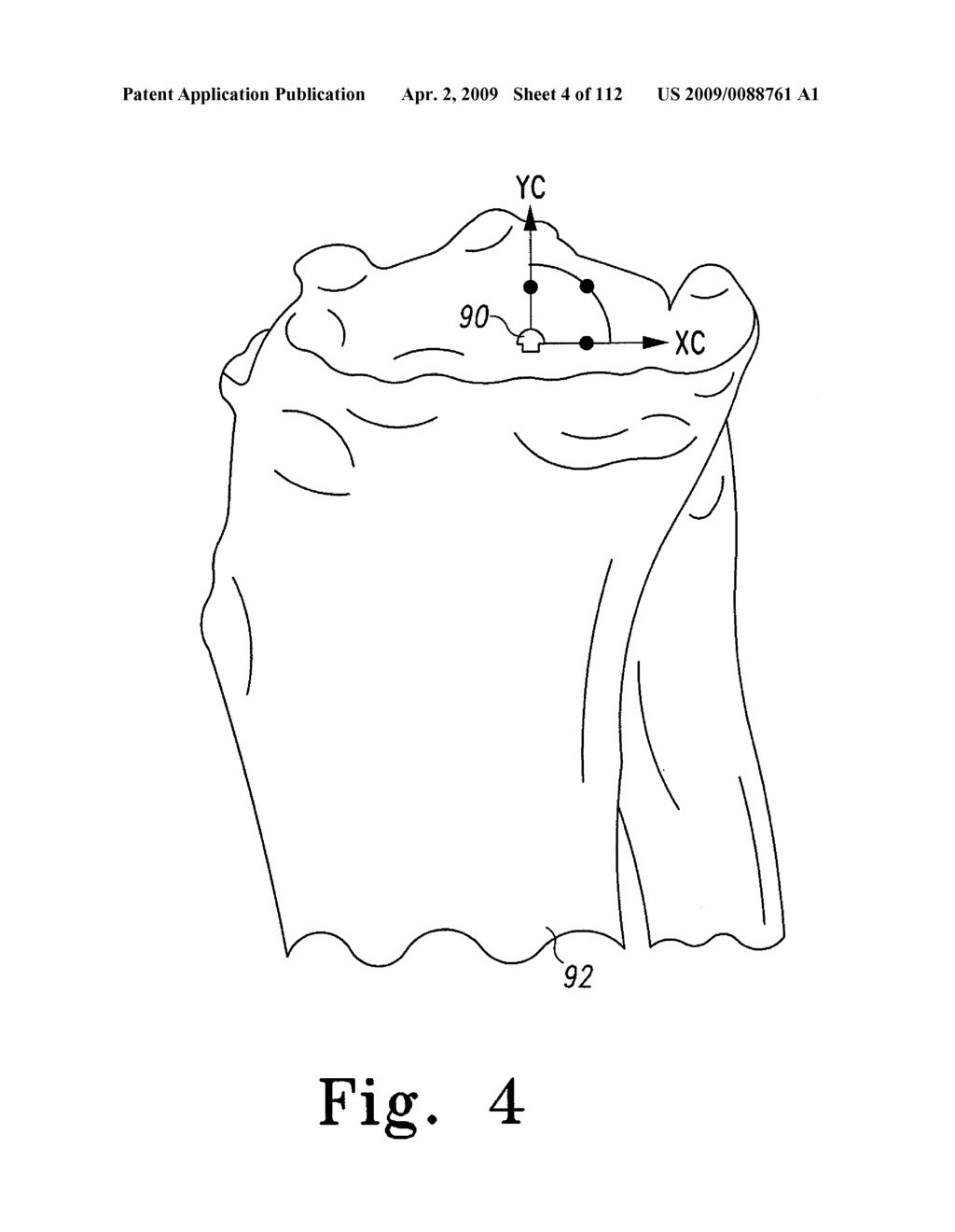 Patient-Customizable Device and System for Performing an Orthopaedic Surgical Procedure - diagram, schematic, and image 05