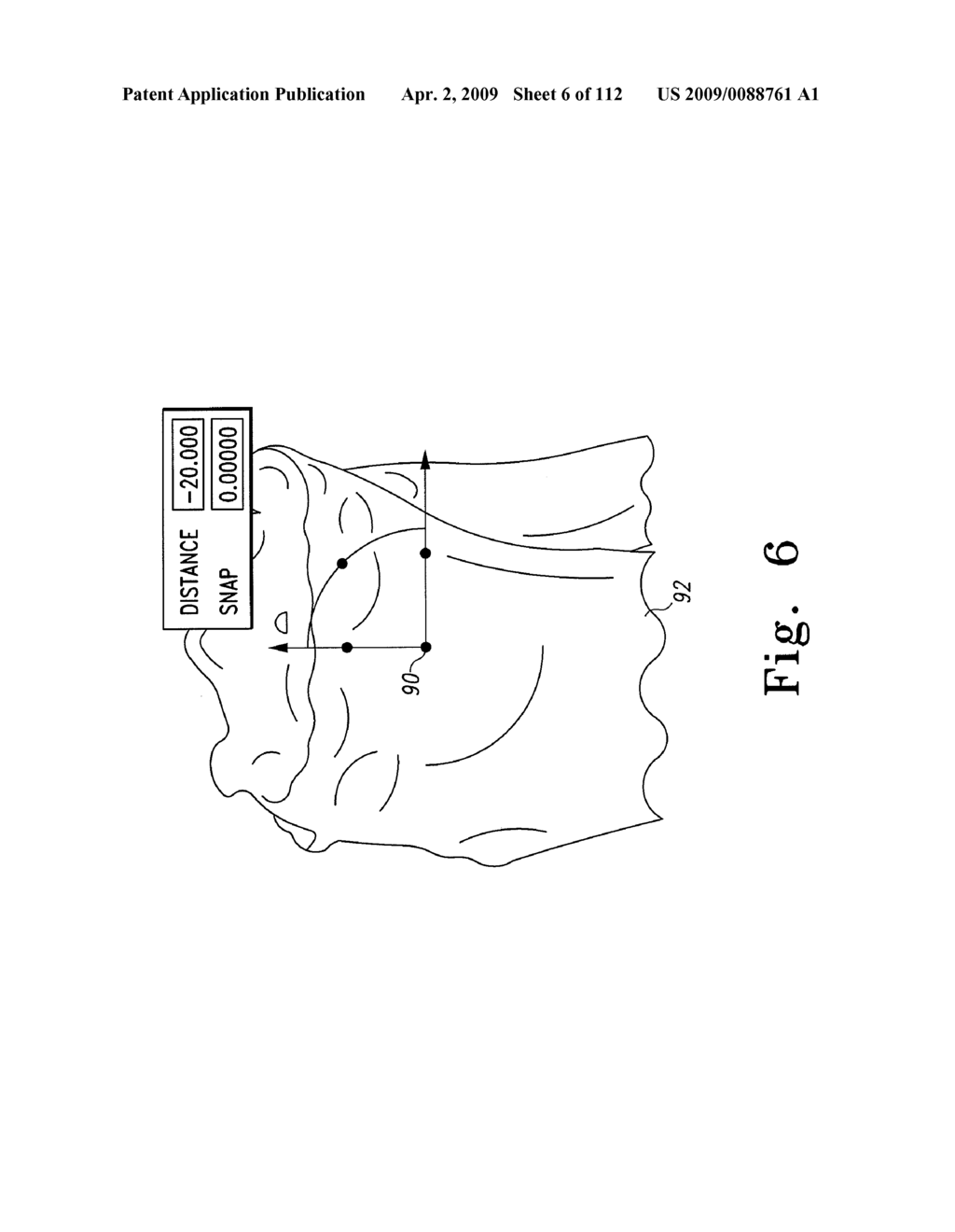 Patient-Customizable Device and System for Performing an Orthopaedic Surgical Procedure - diagram, schematic, and image 07