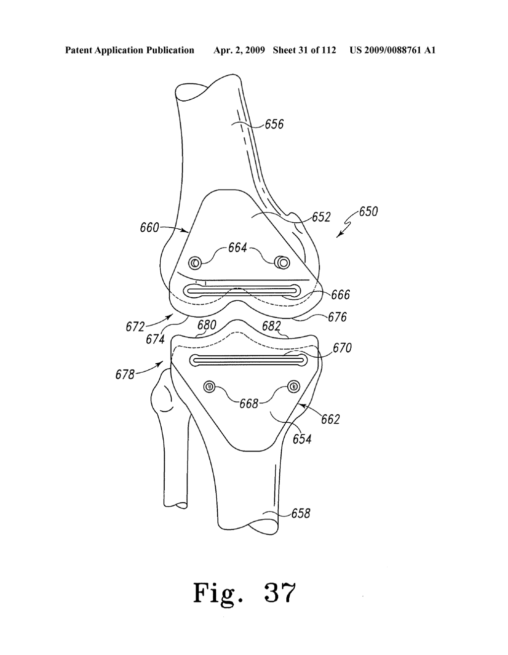 Patient-Customizable Device and System for Performing an Orthopaedic Surgical Procedure - diagram, schematic, and image 32