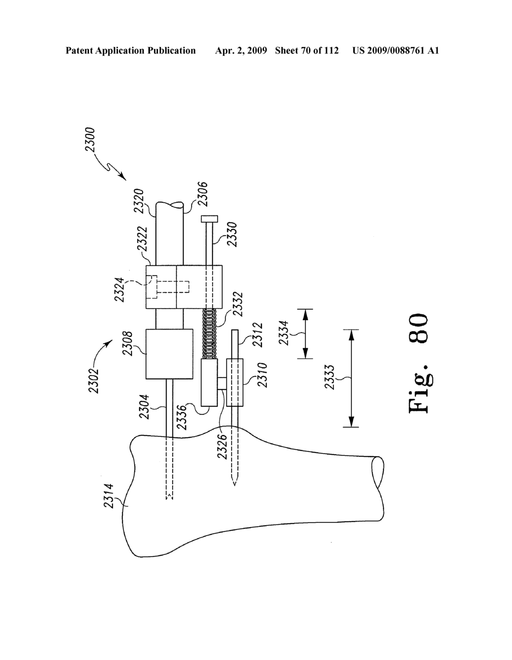 Patient-Customizable Device and System for Performing an Orthopaedic Surgical Procedure - diagram, schematic, and image 71