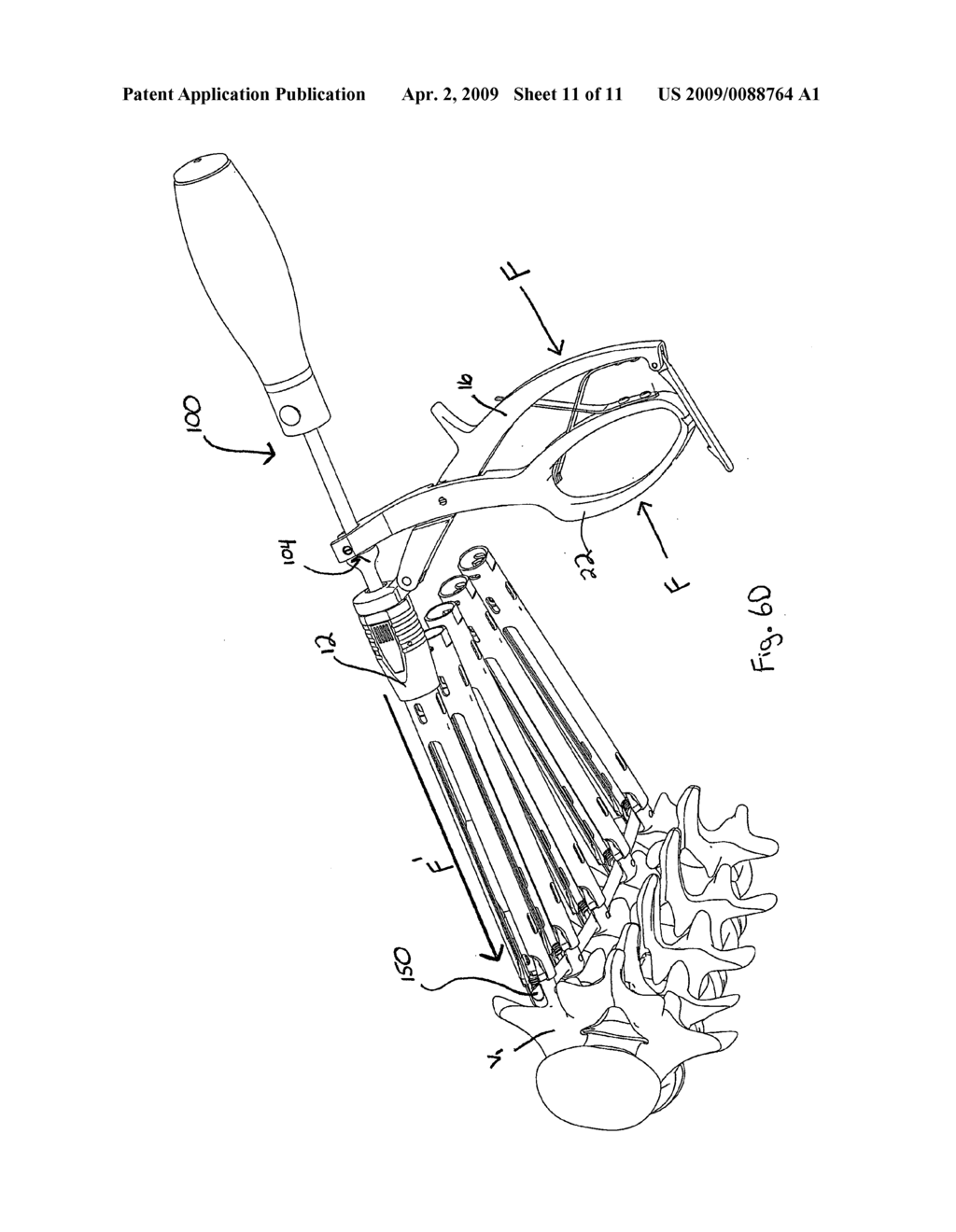 DUAL PIVOT INSTRUMENT FOR REDUCTION OF A FIXATION ELEMENT AND METHOD OF USE - diagram, schematic, and image 12