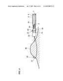 MEDICAL SUTURE AND LIGATURE INSTRUMENT AND MEDICAL SUTURE AND LIGATURE TOOL diagram and image