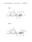 MEDICAL SUTURE AND LIGATURE INSTRUMENT AND MEDICAL SUTURE AND LIGATURE TOOL diagram and image