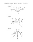 MEDICAL SUTURE AND LIGATURE INSTRUMENT AND MEDICAL SUTURE AND LIGATURE TOOL diagram and image