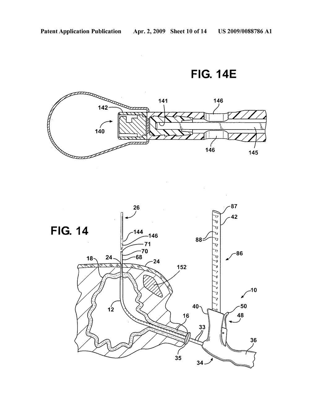 Method of Performing a Suprapubic Transurethral Cystostomy and Associated Procedures and Apparatus Therefor - diagram, schematic, and image 11