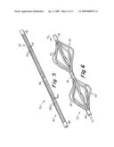 Catch Member for Septal Occluder with Adjustable-Length Center Joint diagram and image